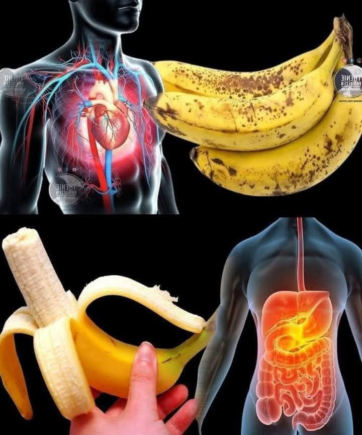 Bananer är en exotisk frukt full av hälsofördelar. Upptäck de näringsmässiga fördelarna med denna köttiga och söta frukt. Bananer är en riktig